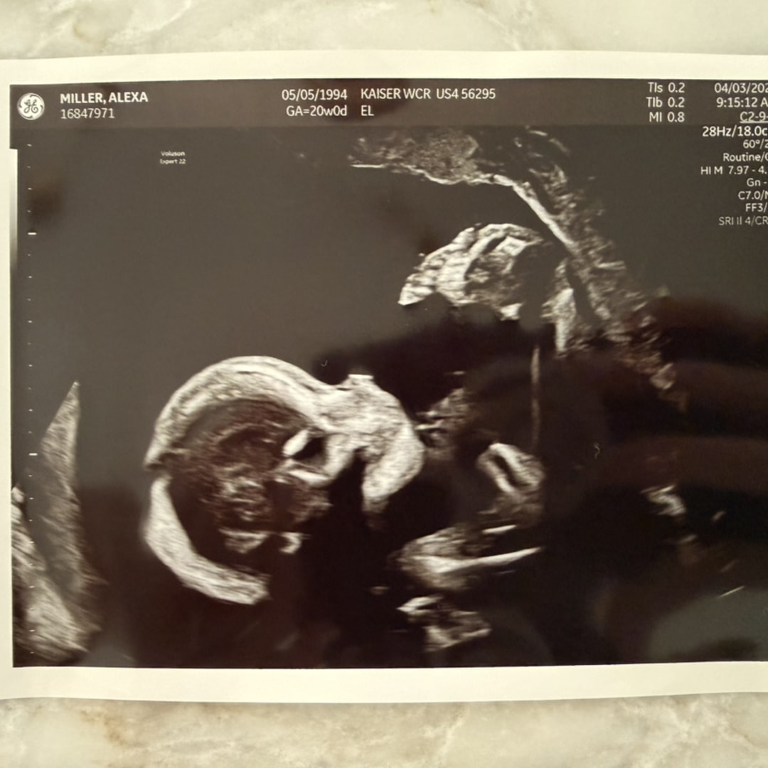 Photo shared by Lexi & Dan for their Babylist baby registry.