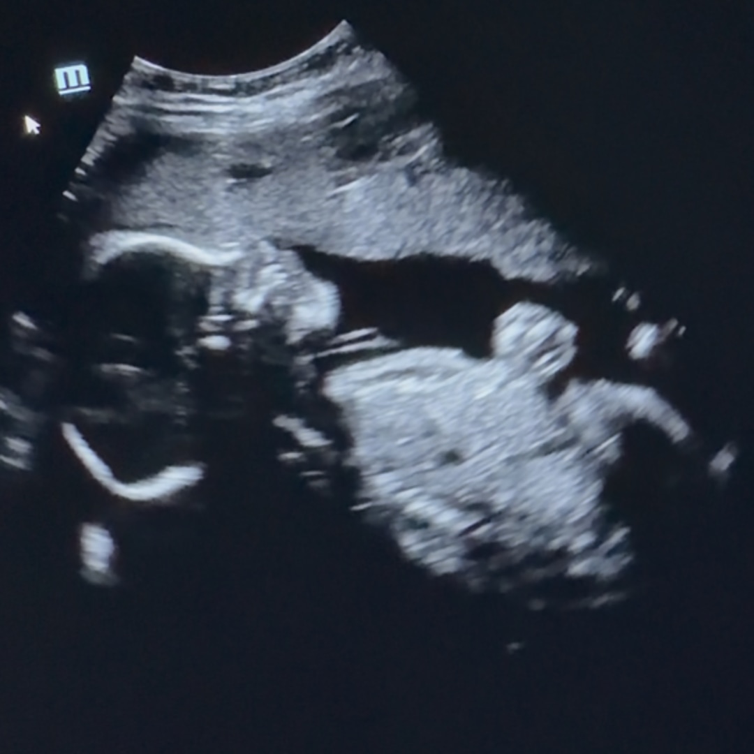 Photo shared by Keilany for their Babylist baby registry.