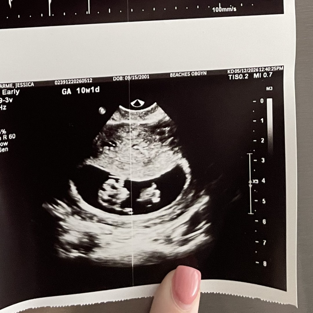 Photo shared by Jessica for their Babylist baby registry.