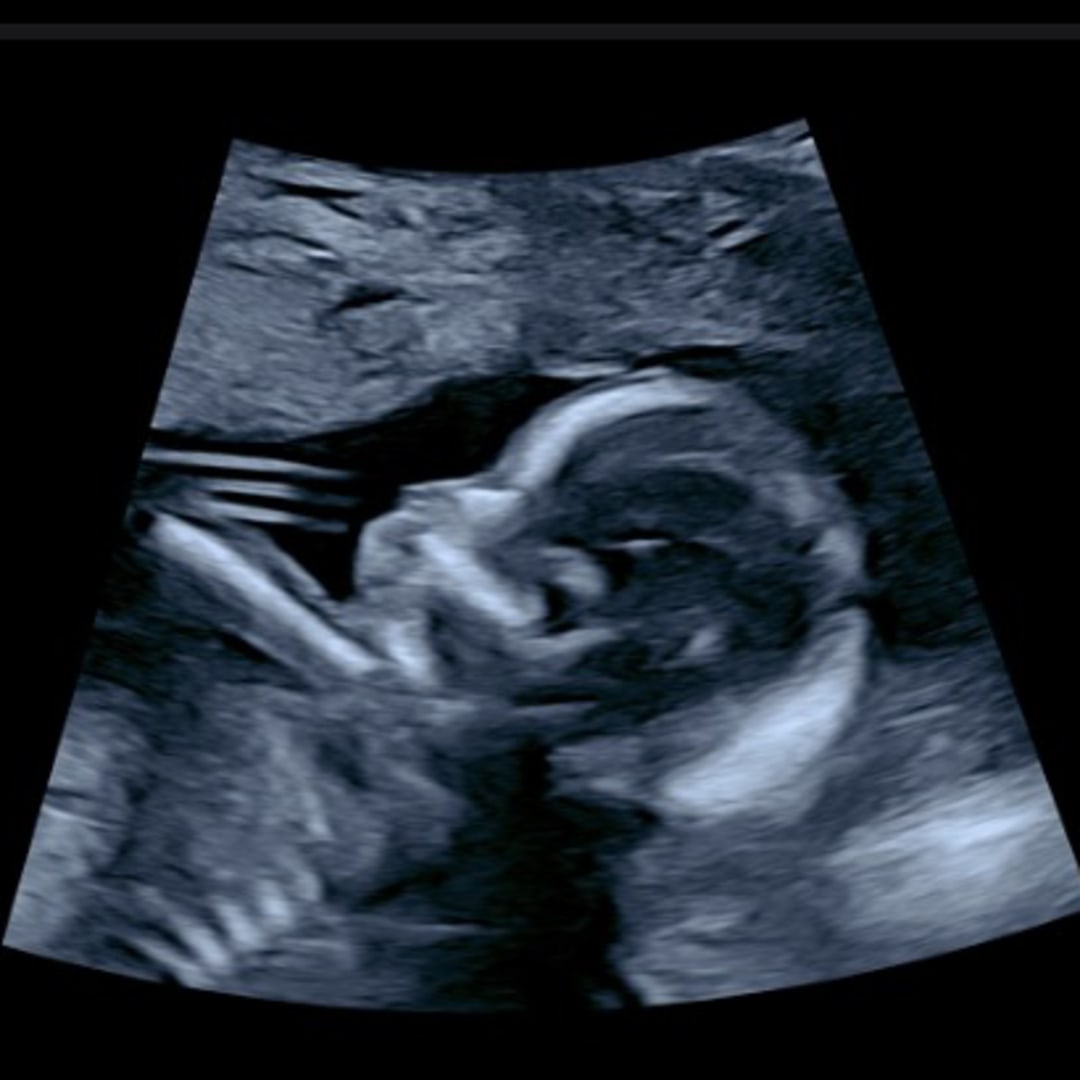 Photo shared by Ashley for their Babylist baby registry.