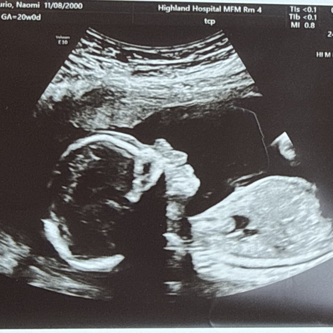 Photo shared by Naomi for their Babylist baby registry.