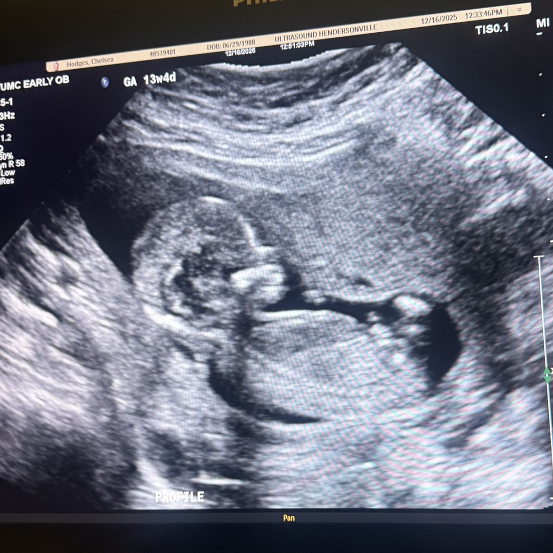 Photo shared by Chelsea for their Babylist baby registry.