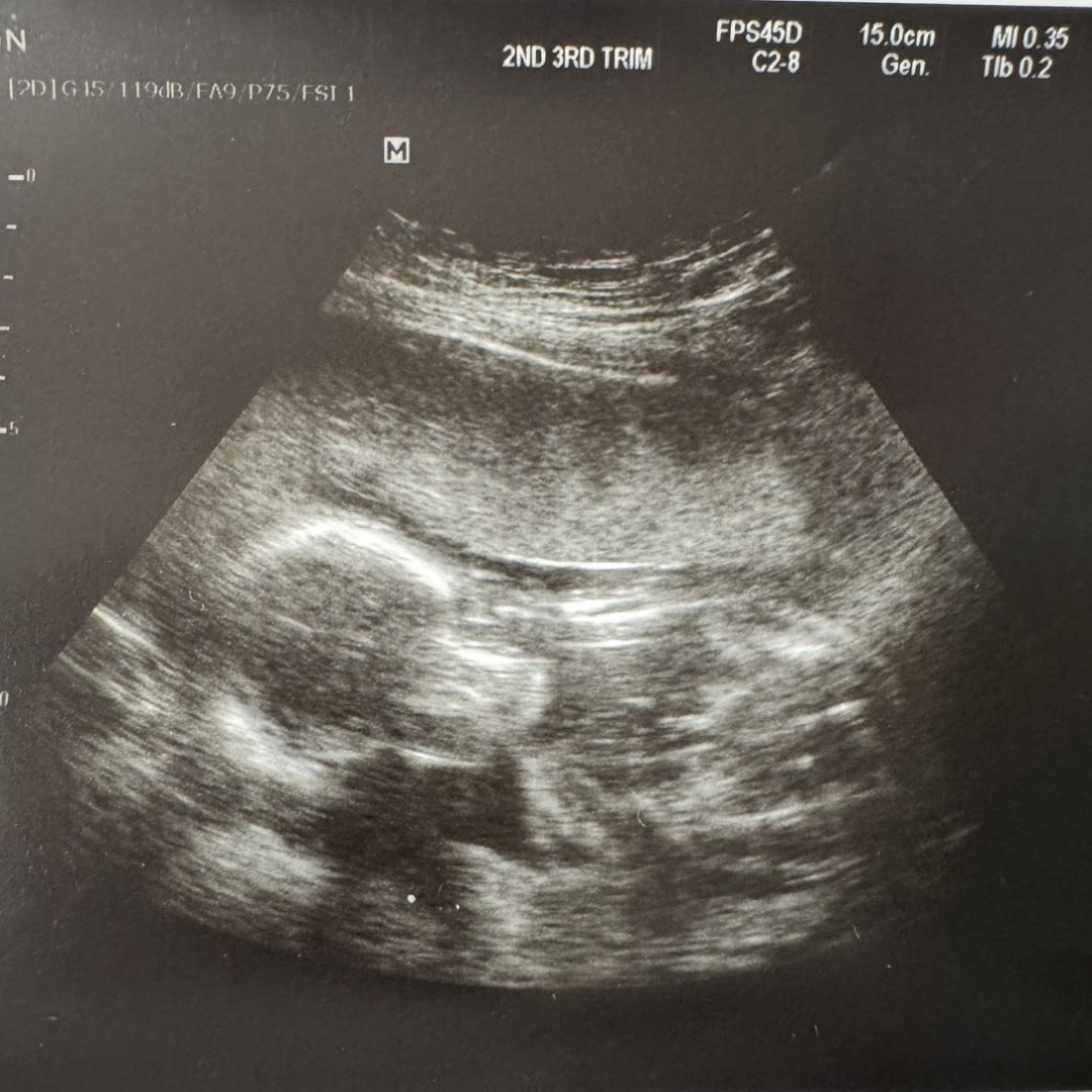 Photo shared by Kimberly for their Babylist baby registry.