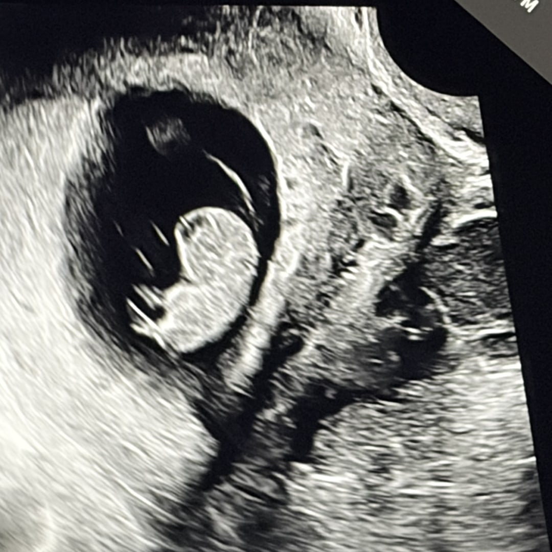 Photo shared by Natalee for their Babylist baby registry.