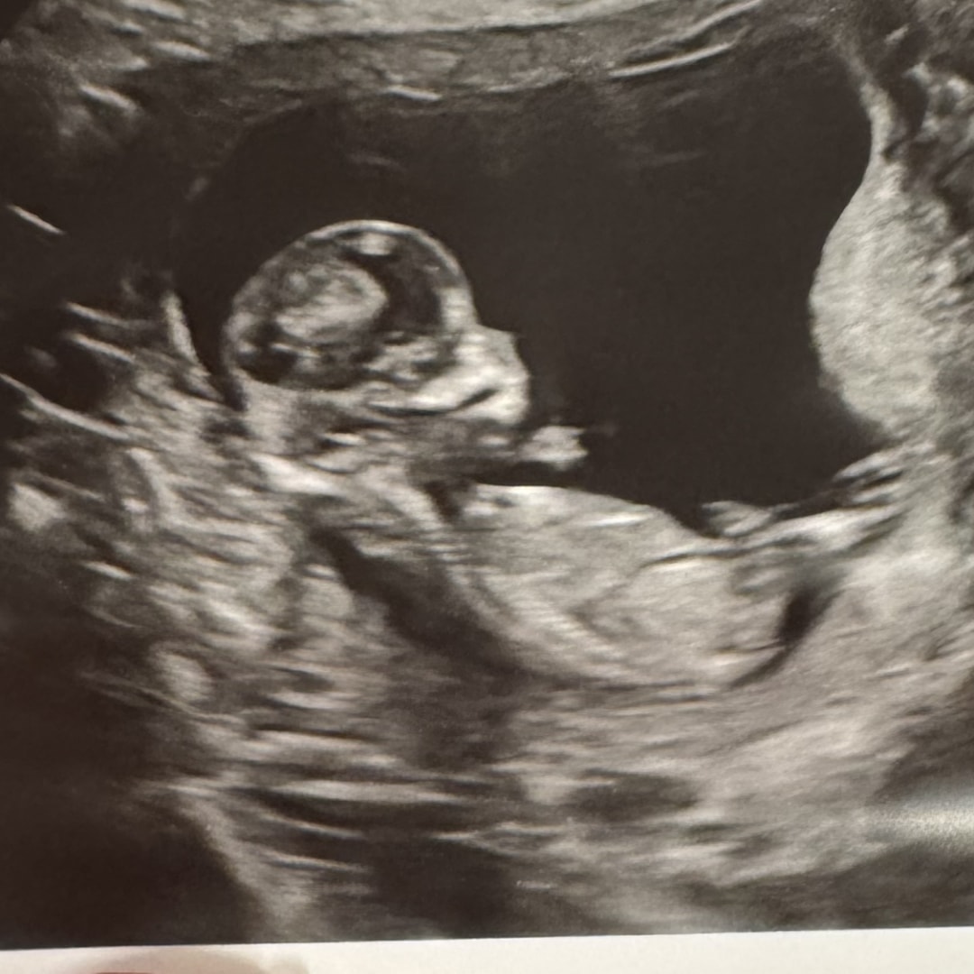 Photo shared by Jackie for their Babylist baby registry.