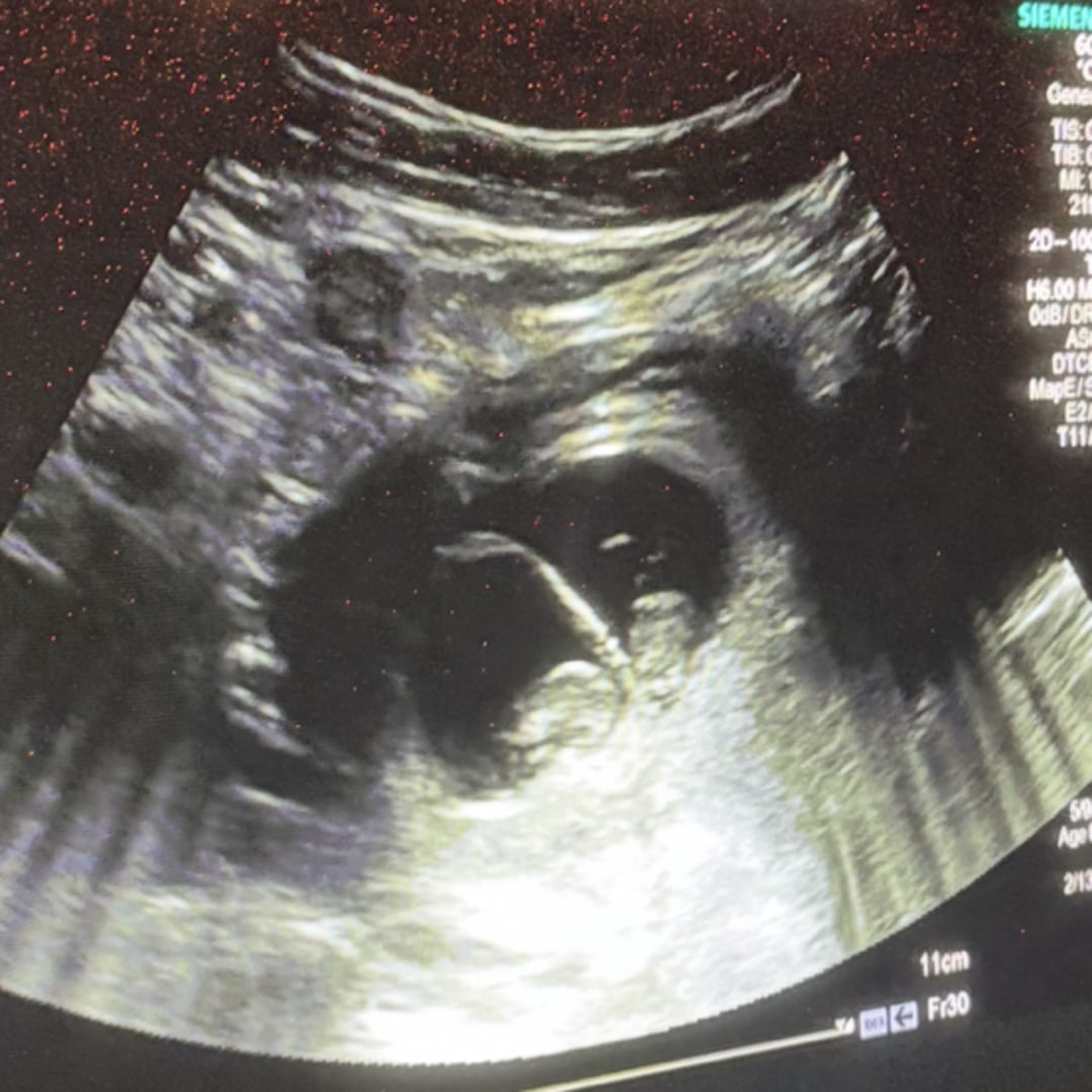 Photo shared by Lauren for their Babylist baby registry.