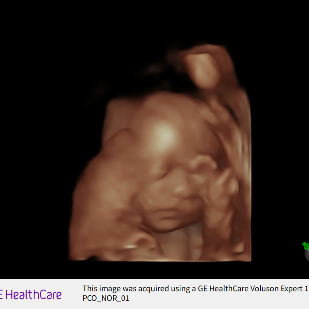 Photo shared by Taryn for their Babylist baby registry.