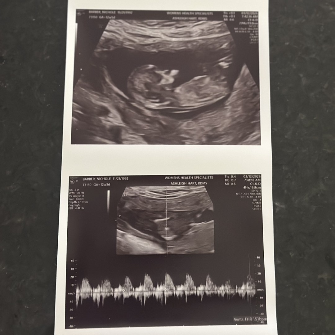 Photo shared by Nichole for their Babylist baby registry.
