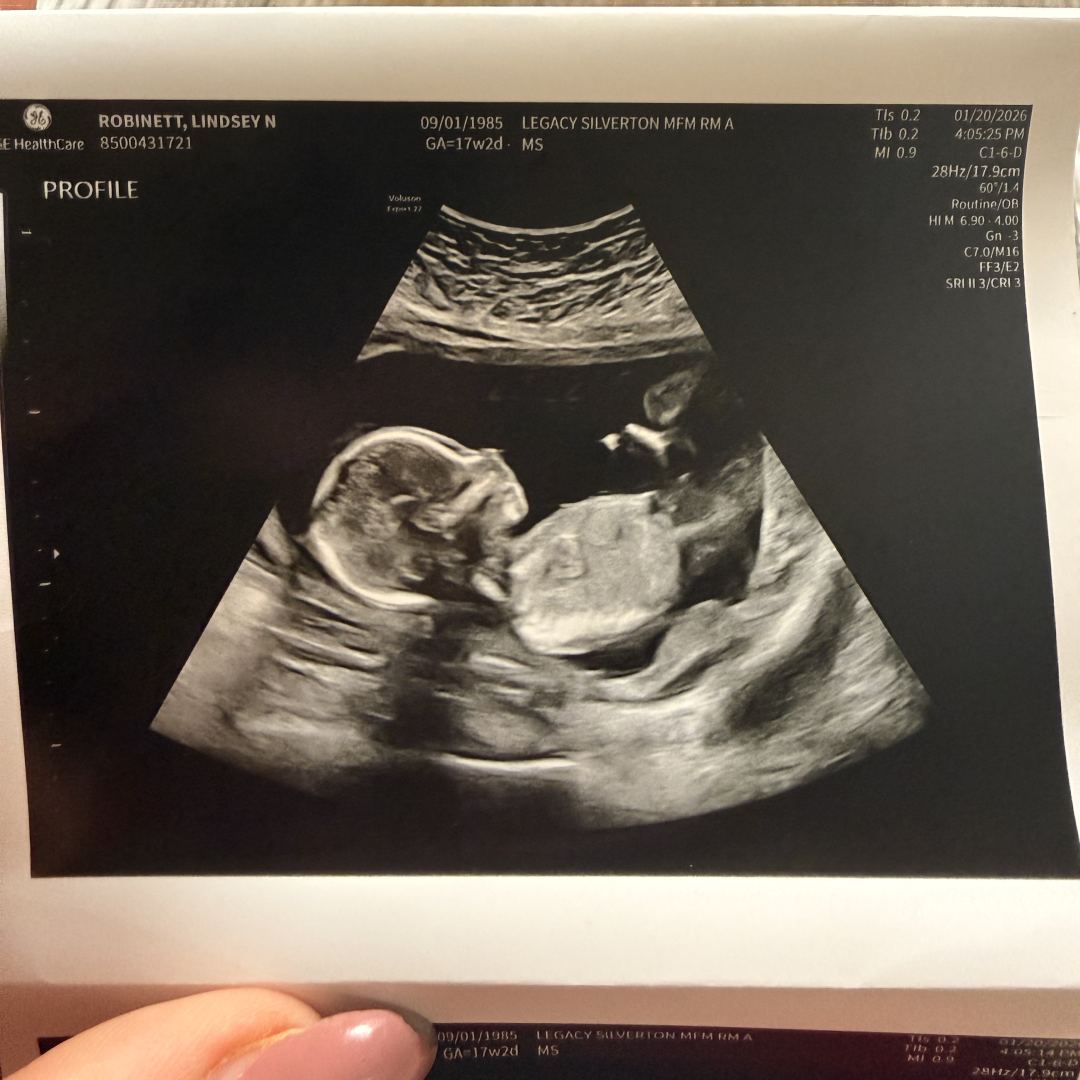 Photo shared by Lindsey for their Babylist baby registry.