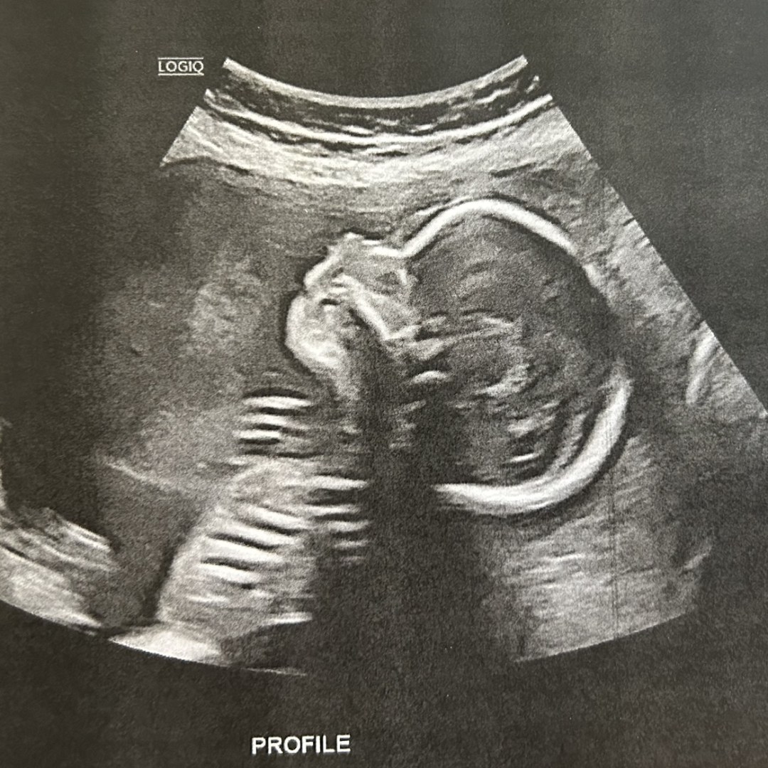 Photo shared by Gabriella for their Babylist baby registry.