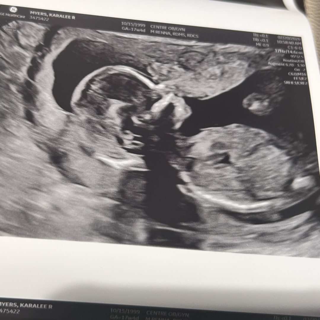 Photo shared by Rassy for their Babylist baby registry.