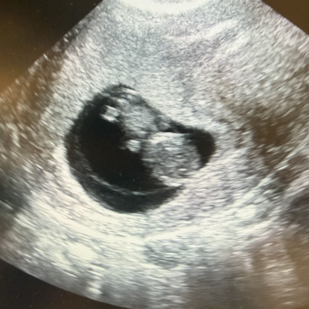 Photo shared by Hannah for their Babylist baby registry.