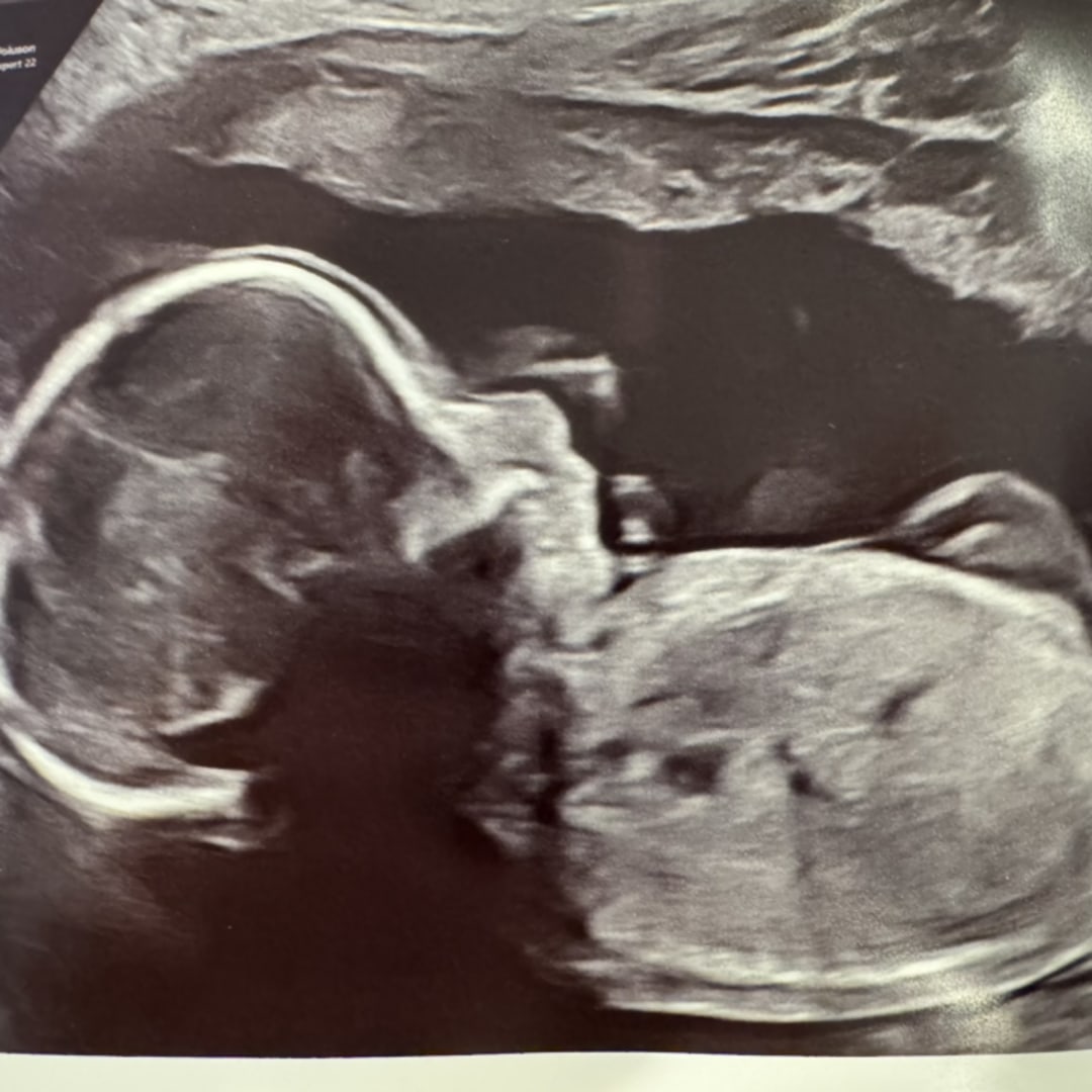 Photo shared by Jessica for their Babylist baby registry.