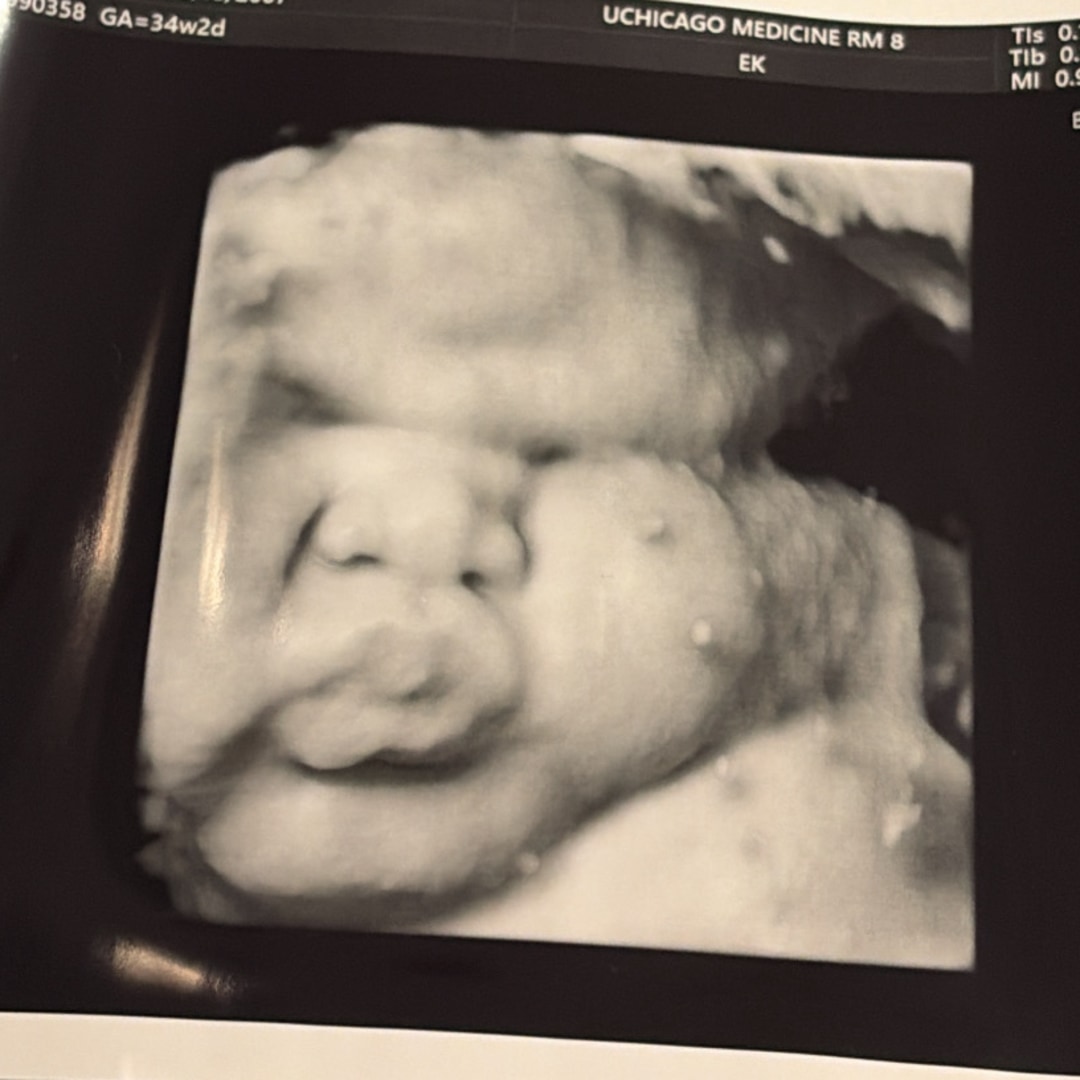 Photo shared by Alana & for their Babylist baby registry.
