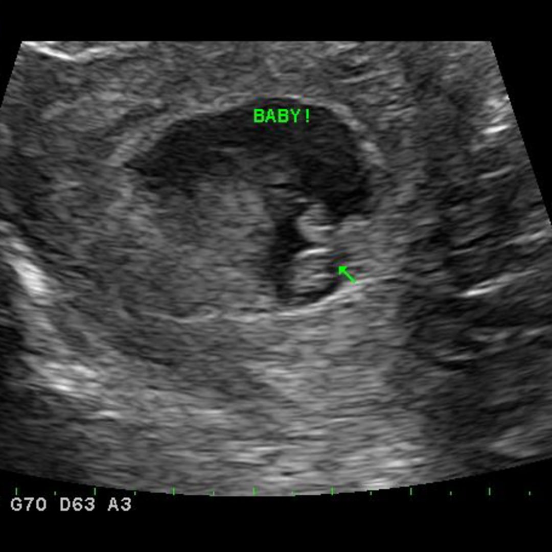 Photo shared by Emilie for their Babylist baby registry.