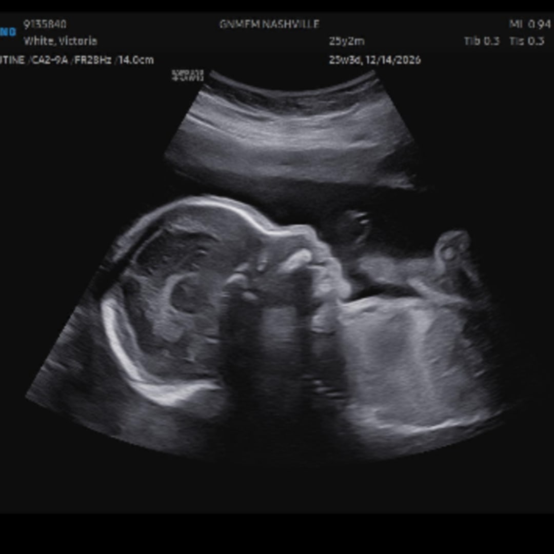 Photo shared by Victoria for their Babylist baby registry.