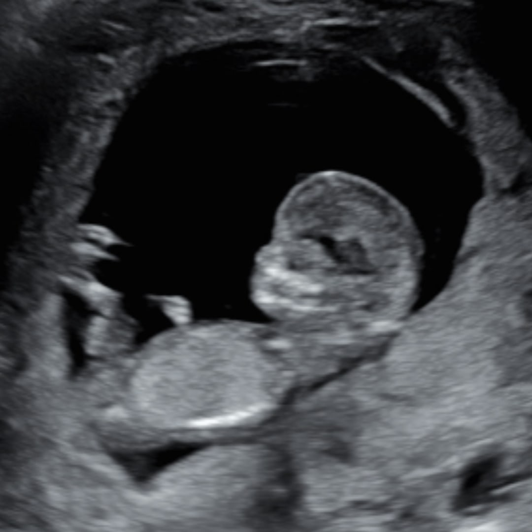 Photo shared by Erika for their Babylist baby registry.