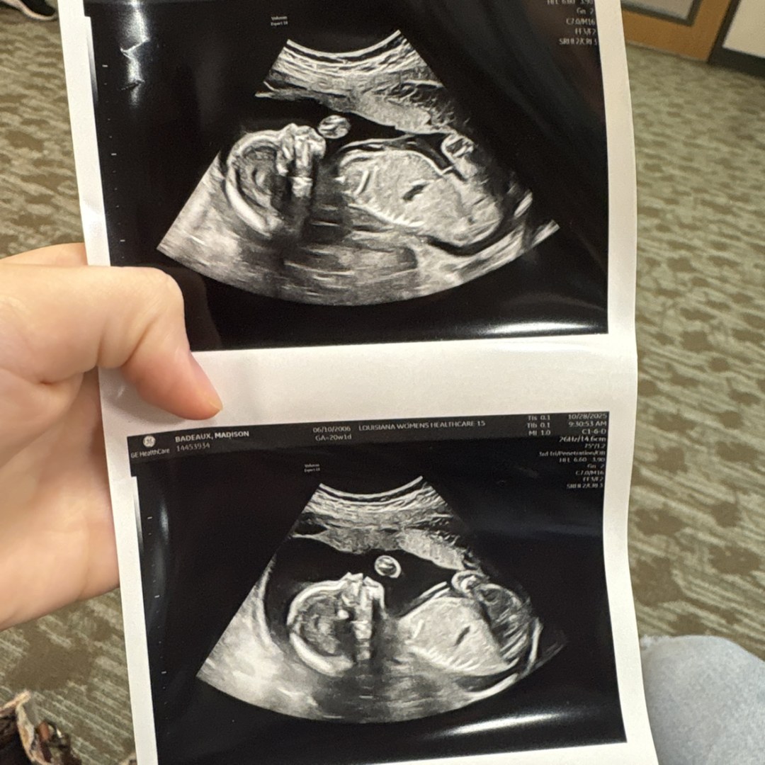 Photo shared by Madison for their Babylist baby registry.