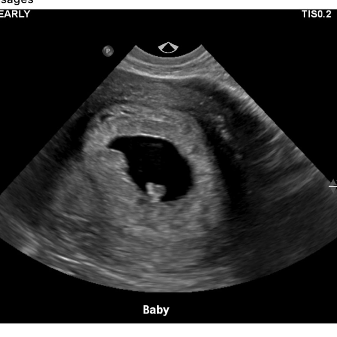 Photo shared by Jillian for their Babylist baby registry.