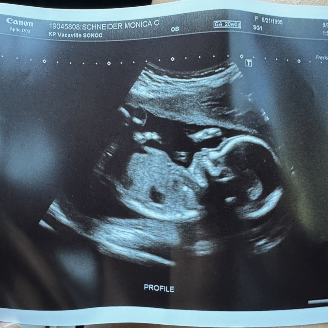 Photo shared by Monica for their Babylist baby registry.