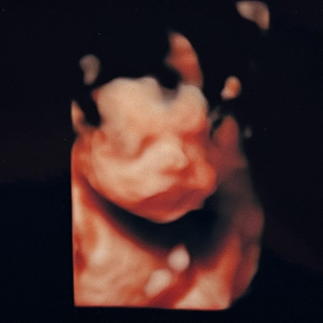 Photo shared by Alyssa for their Babylist baby registry.