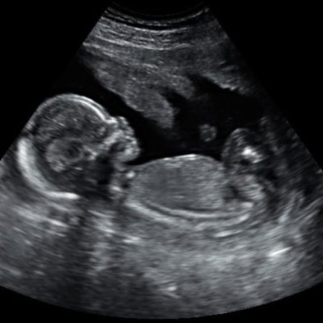 Photo shared by Chelsey for their Babylist baby registry.