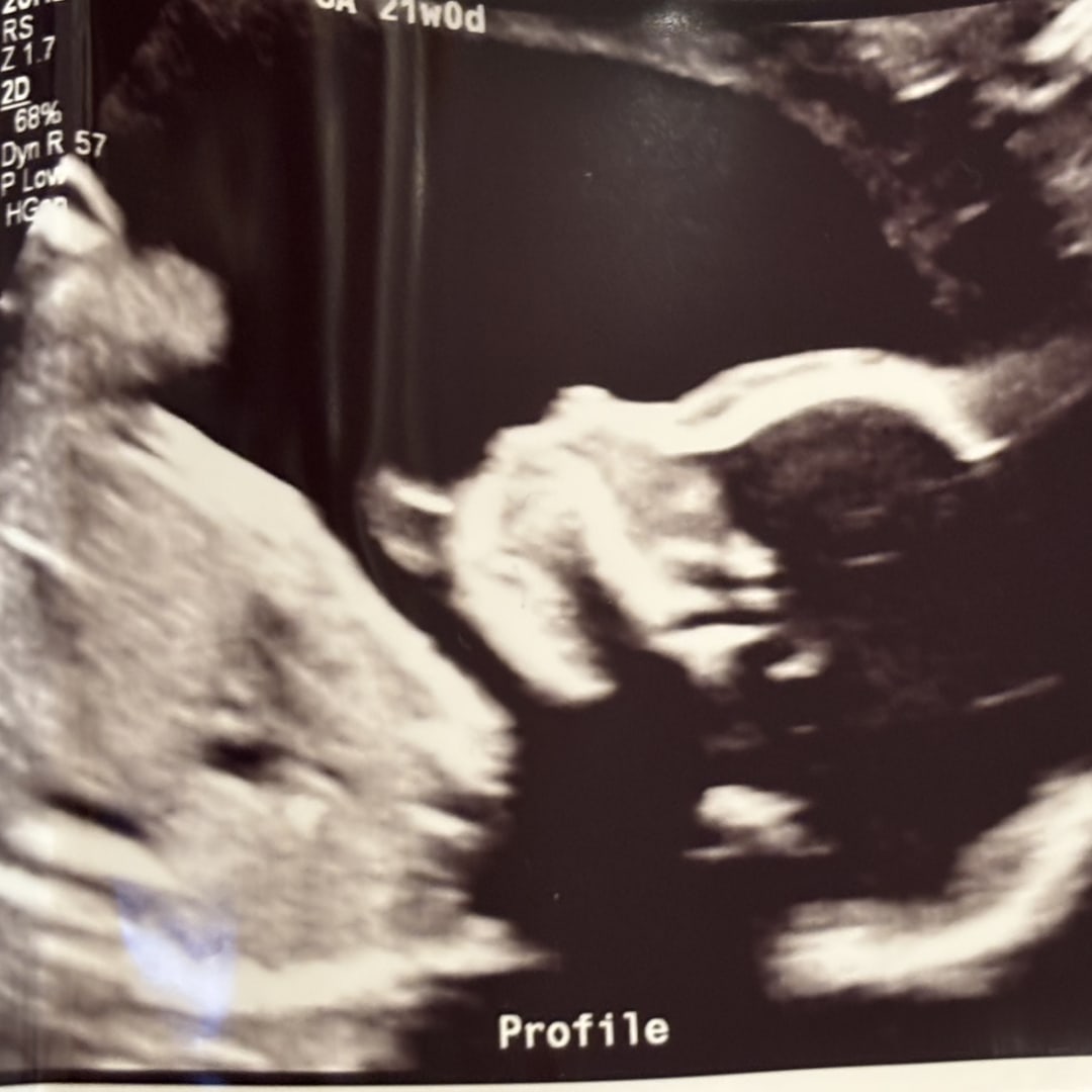 Photo shared by Brittny for their Babylist baby registry.