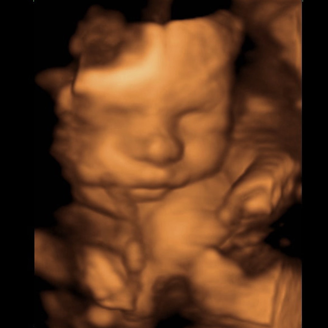 Photo shared by Amber for their Babylist baby registry.