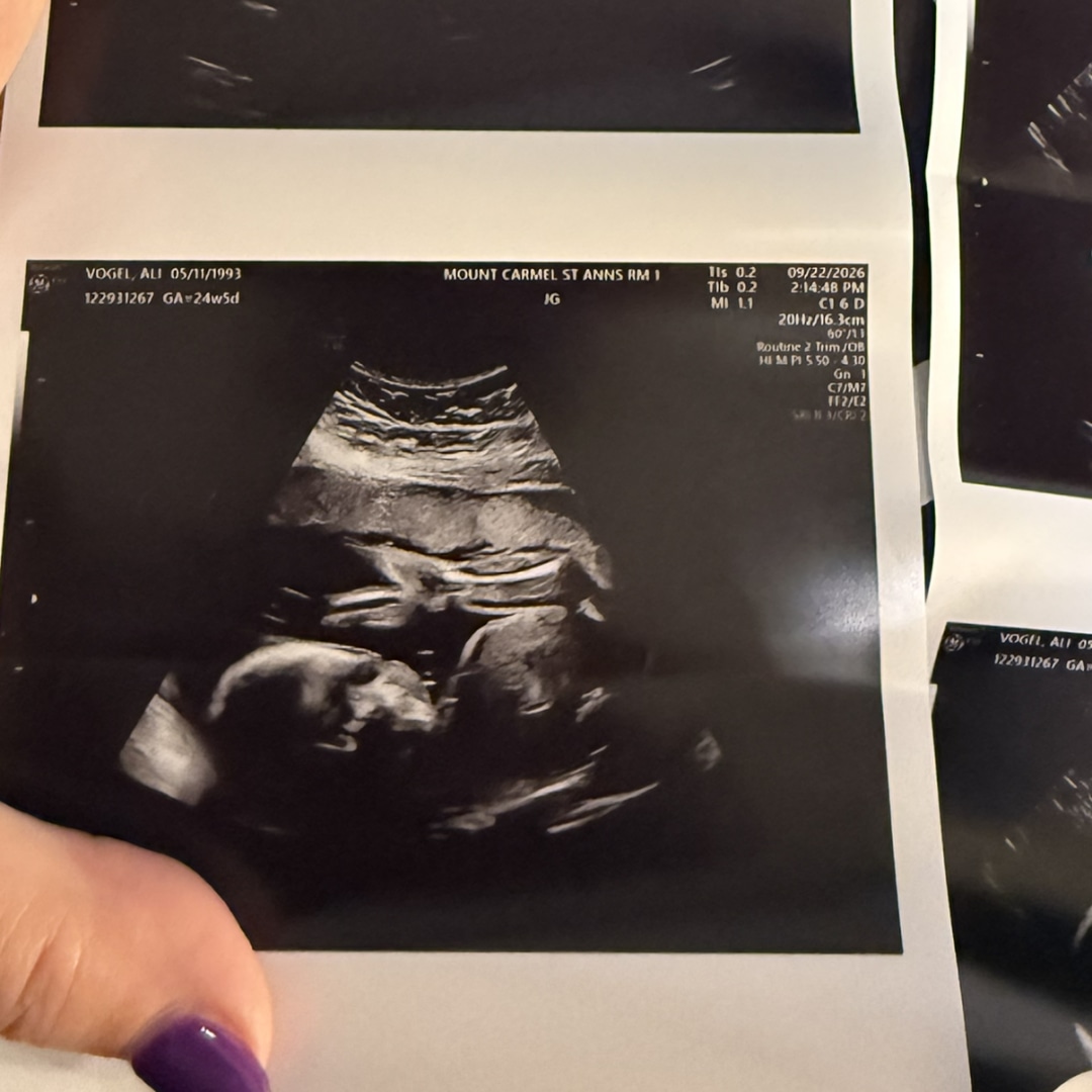 Photo shared by Ali for their Babylist baby registry.