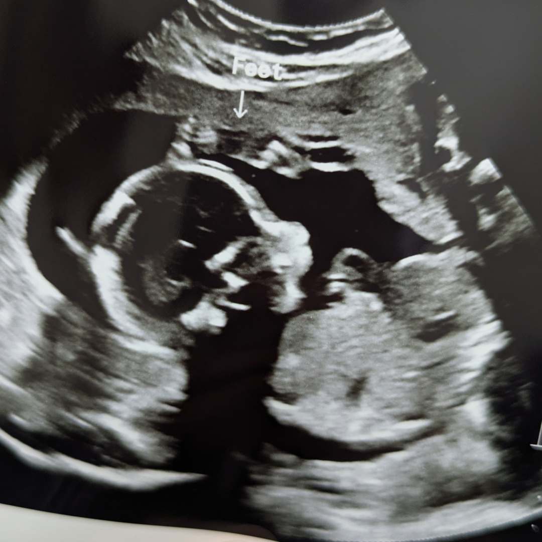 Photo shared by Shelby for their Babylist baby registry.