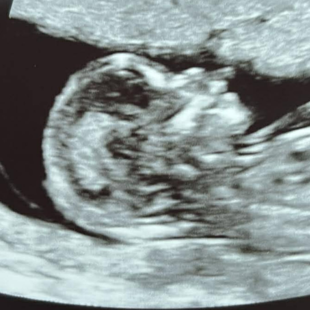 Photo shared by Sara for their Babylist baby registry.