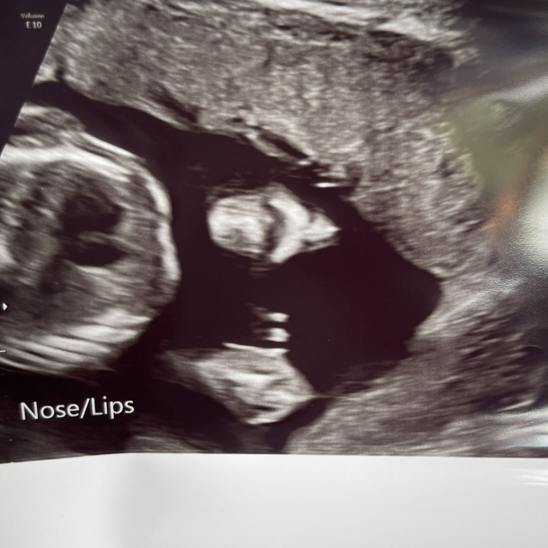 Photo shared by Tiffany for their Babylist baby registry.