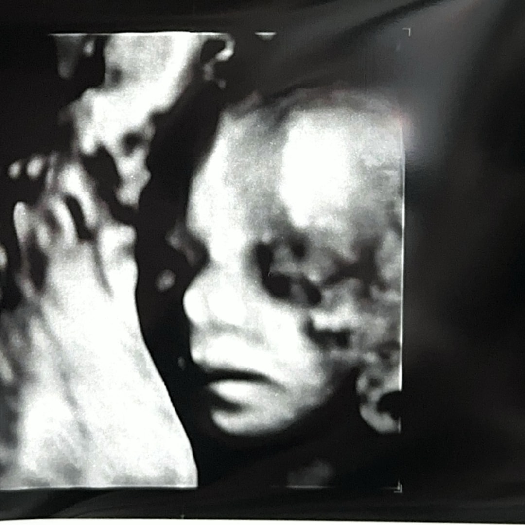 Photo shared by Anna and John for their Babylist baby registry.