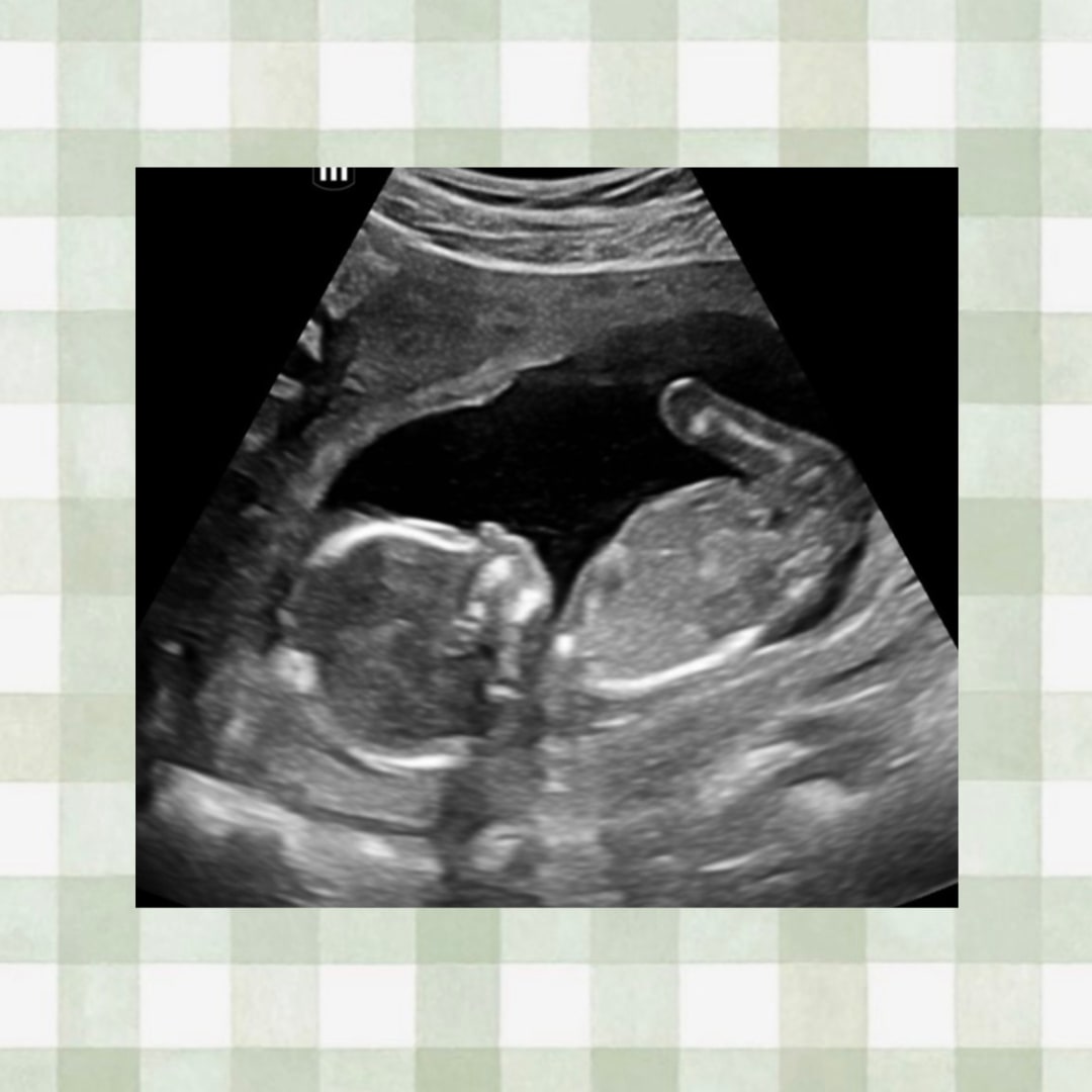 Photo shared by Colleena for their Babylist baby registry.