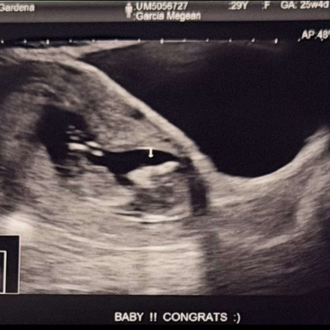 Photo shared by Megean Rose for their Babylist baby registry.