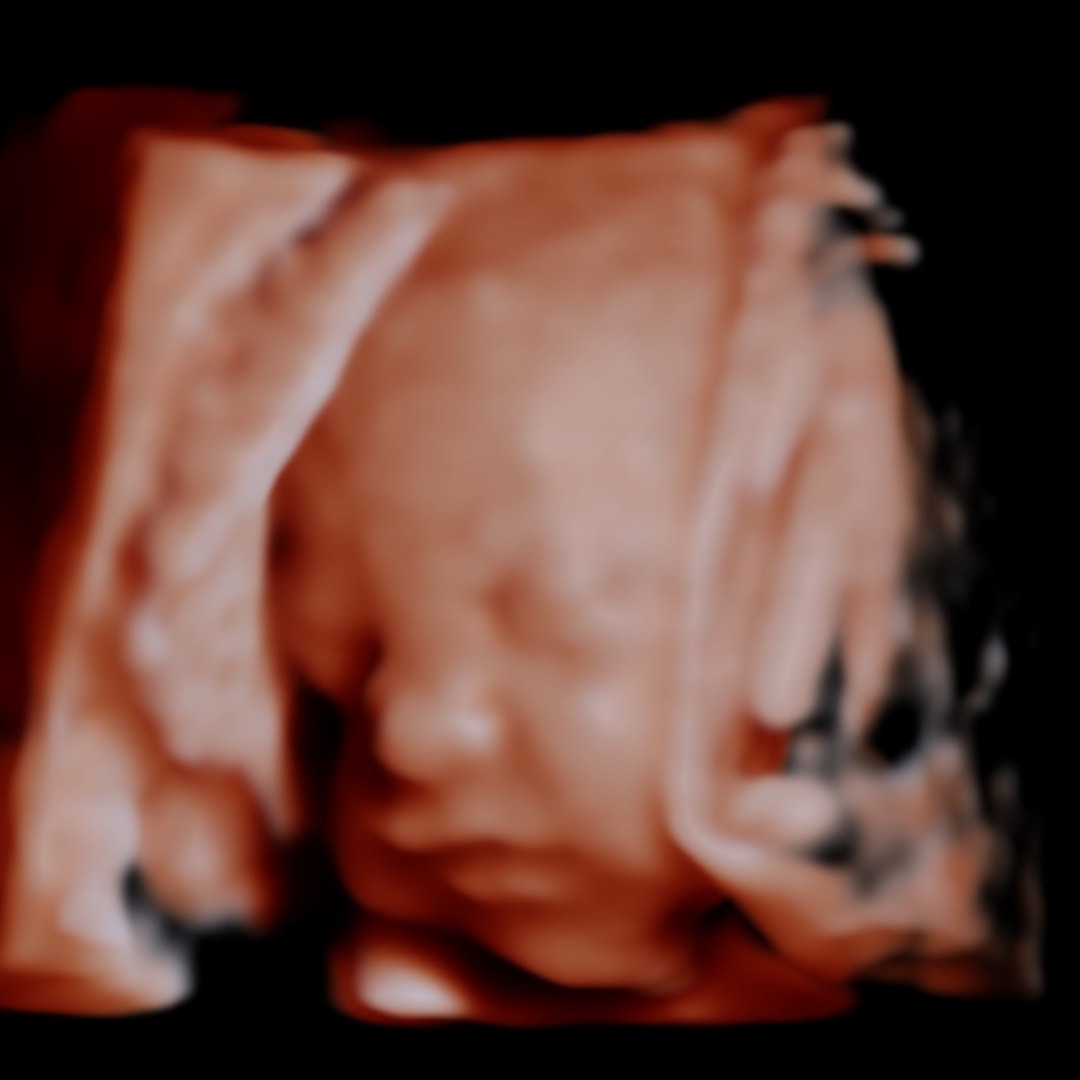 Photo shared by Elma for their Babylist baby registry.