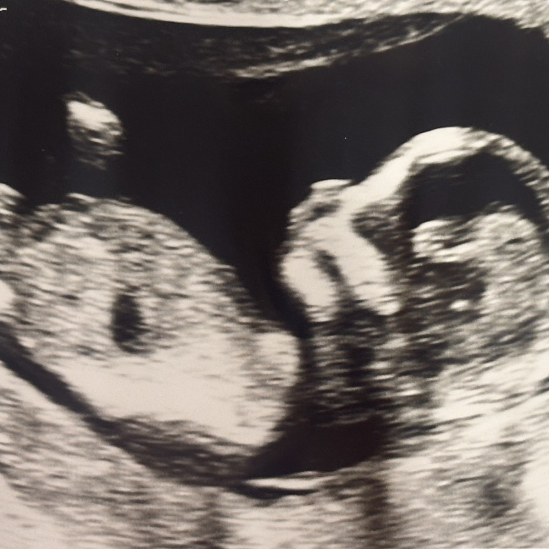 Photo shared by Emma for their Babylist baby registry.
