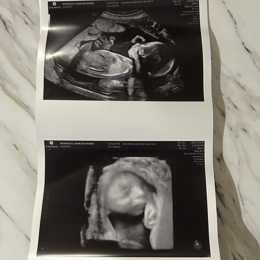 Photo shared by Vanessa for their Babylist baby registry.