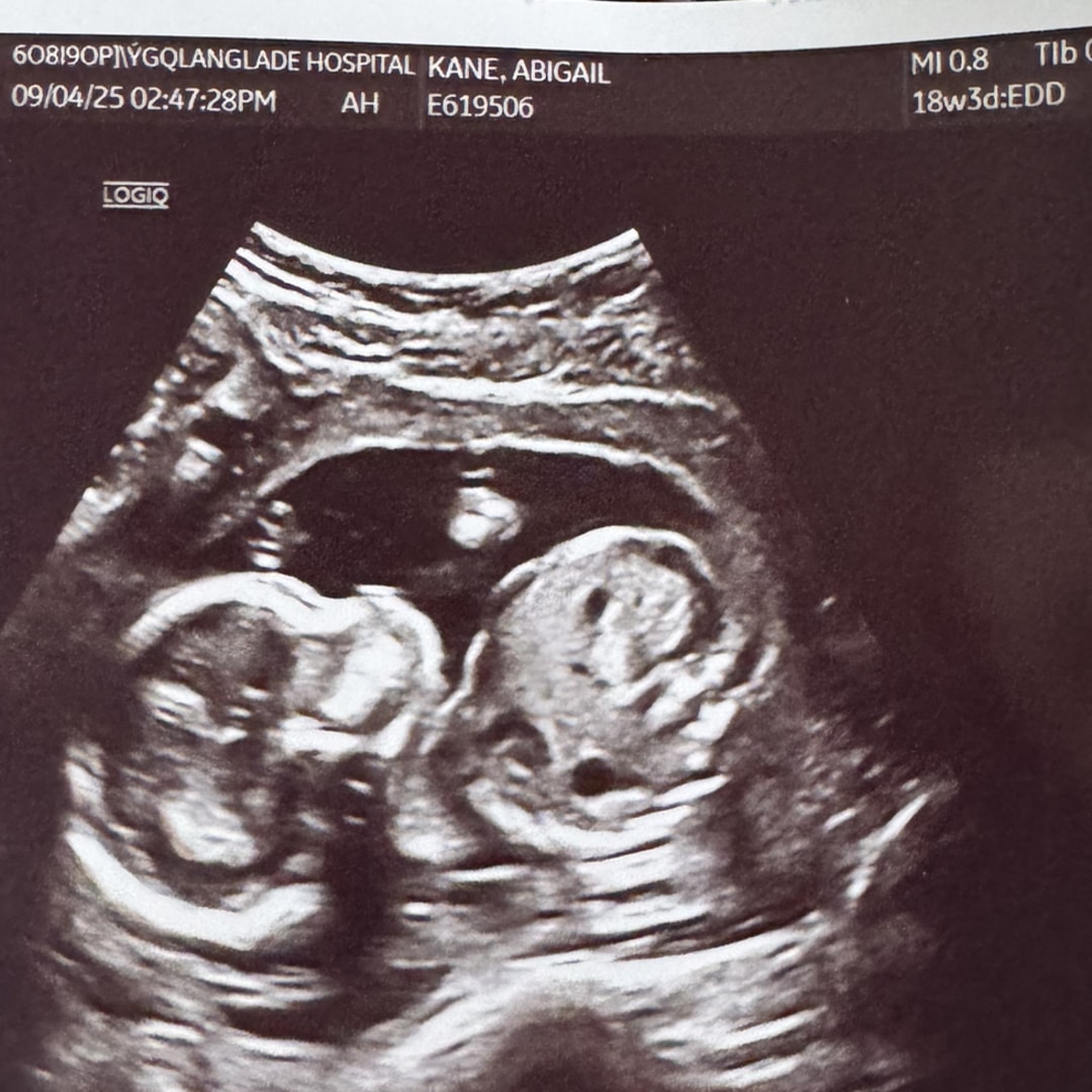 Photo shared by Abby for their Babylist baby registry.