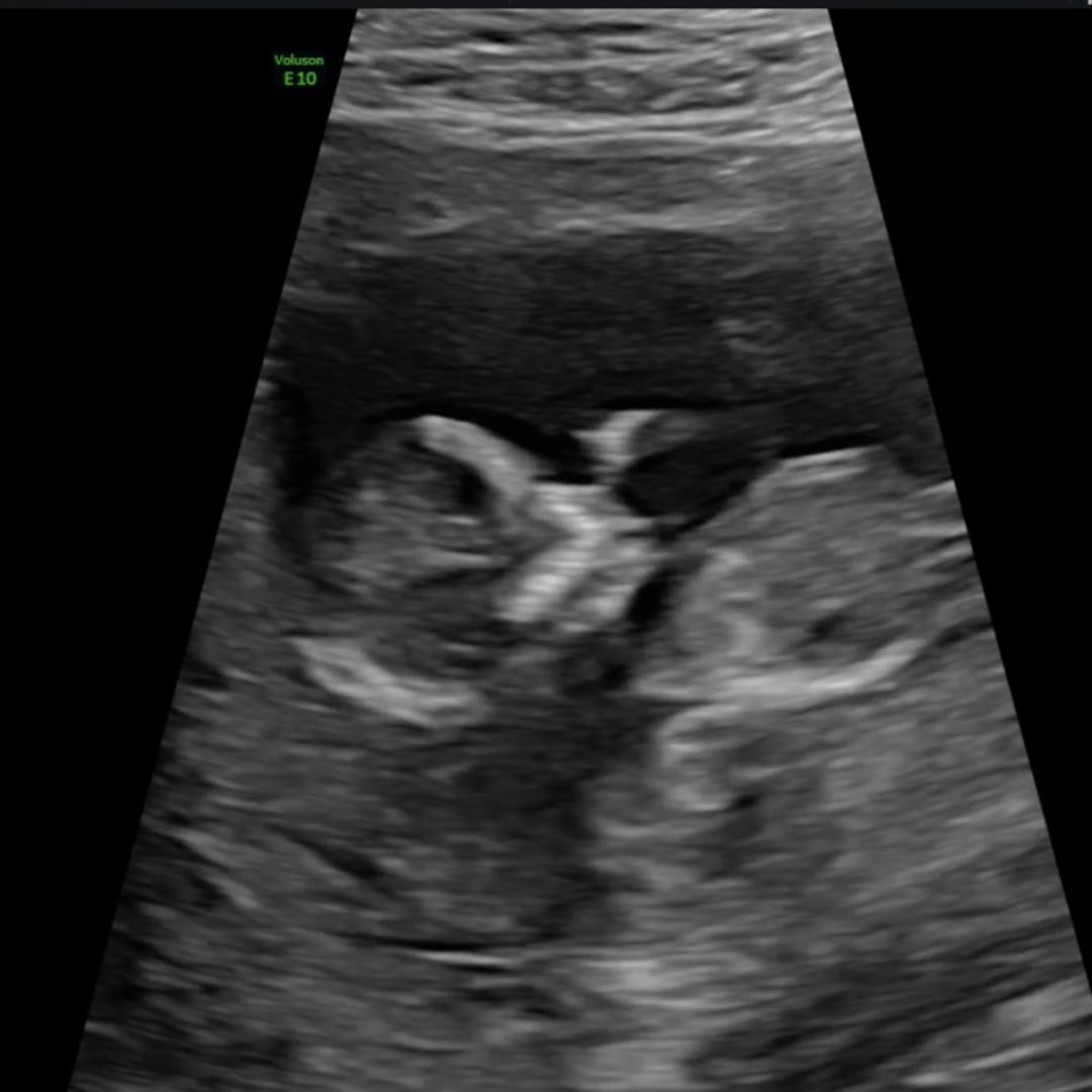 Photo shared by Briana for their Babylist baby registry.