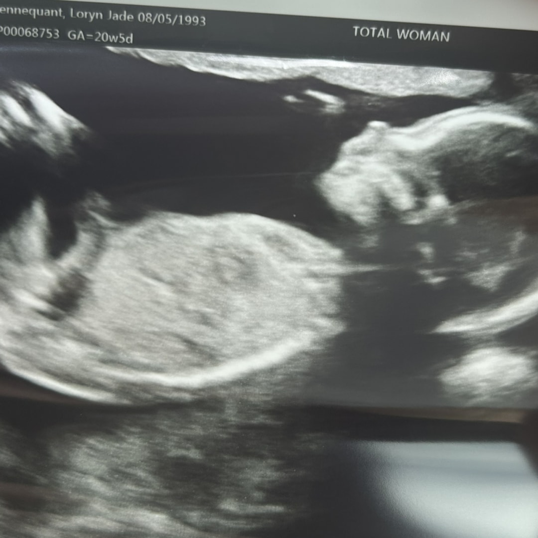 Photo shared by Loryn for their Babylist baby registry.