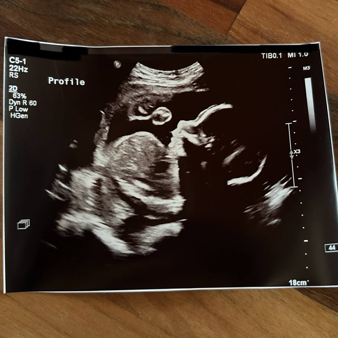 Photo shared by Elena for their Babylist baby registry.
