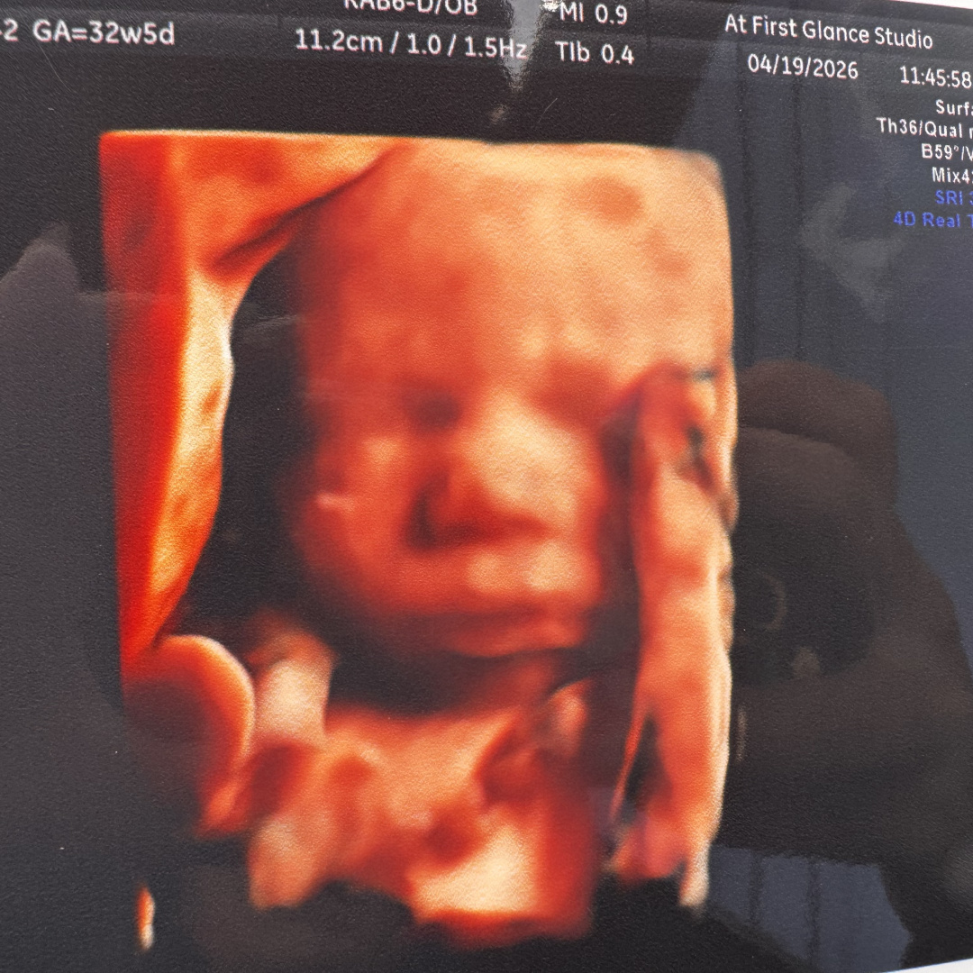 Photo shared by Karlie for their Babylist baby registry.