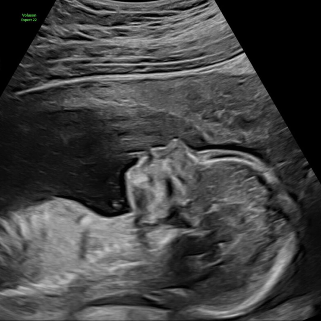 Photo shared by Jacqueline for their Babylist baby registry.