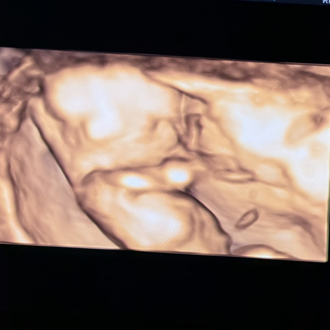 Photo shared by Merisa for their Babylist baby registry.