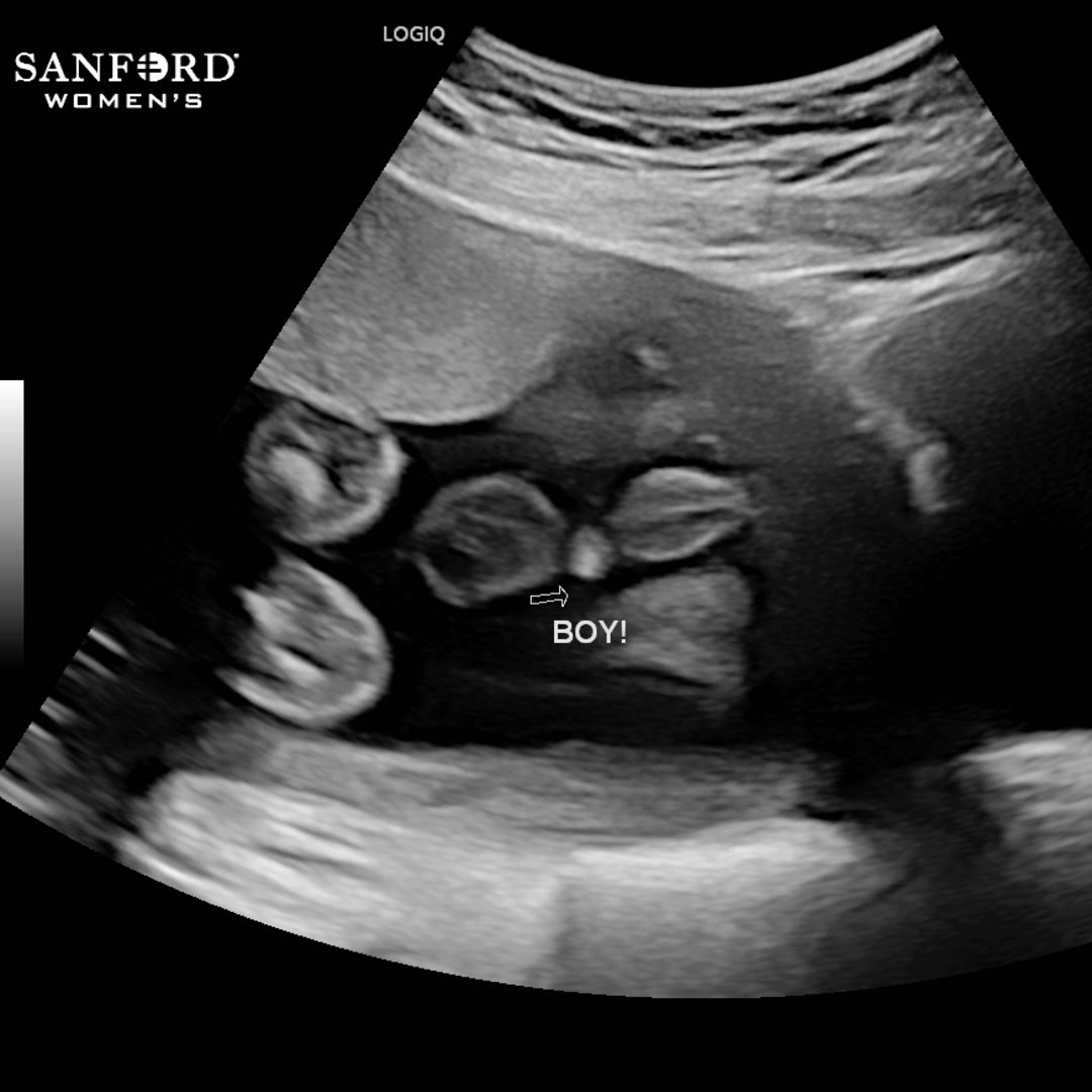 Photo shared by Adair for their Babylist baby registry.