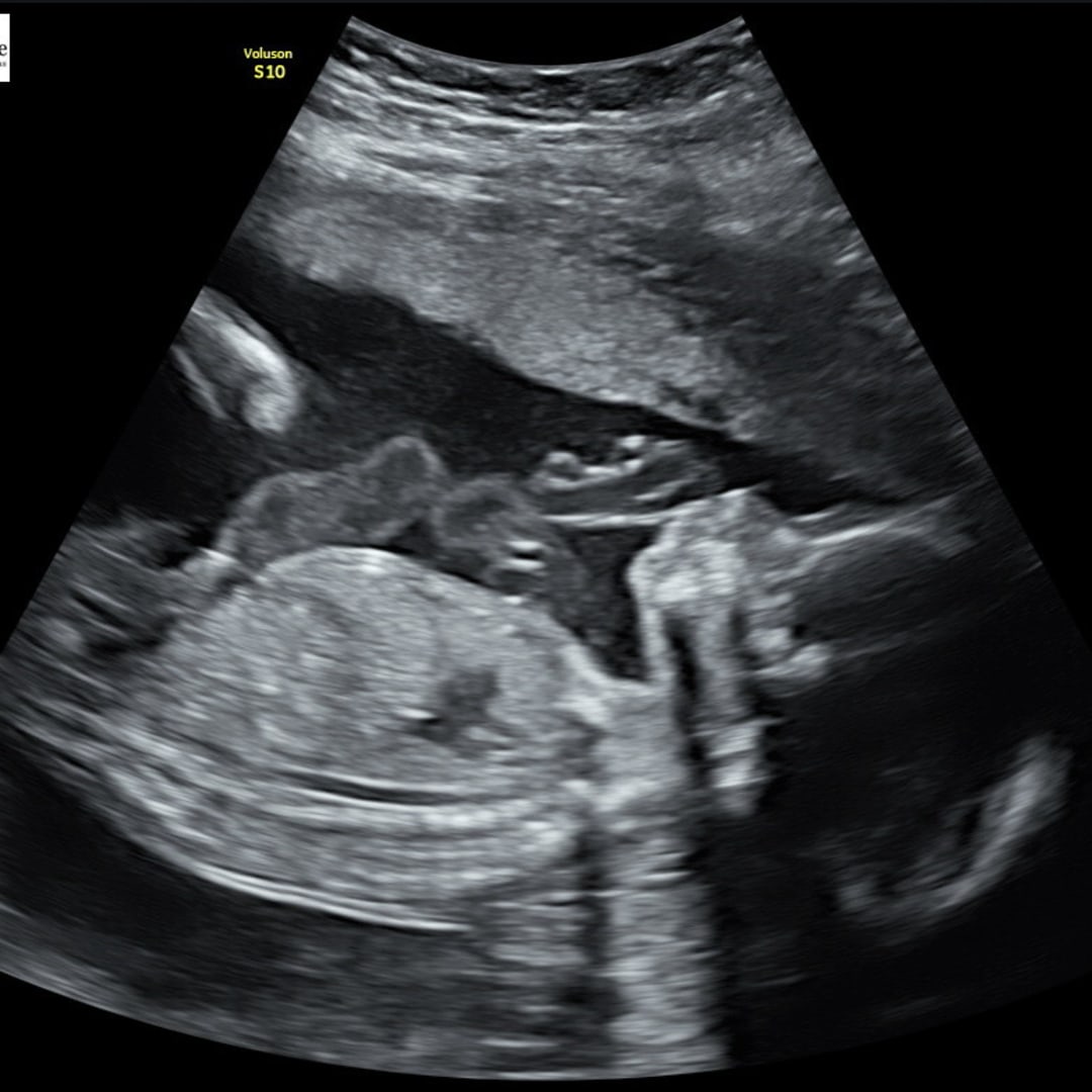 Photo shared by Aylin for their Babylist baby registry.