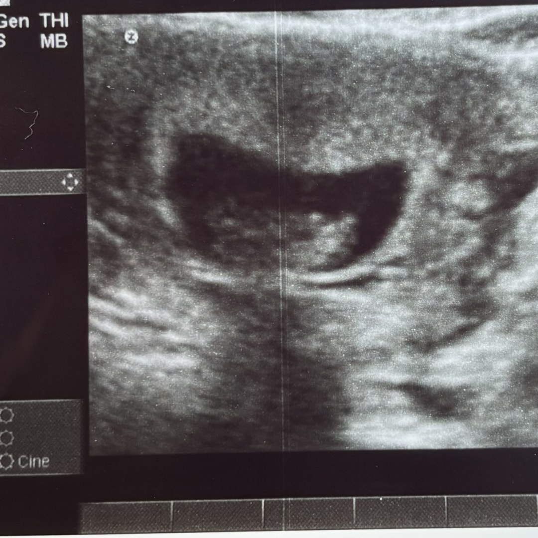 Photo shared by Jordan for their Babylist baby registry.