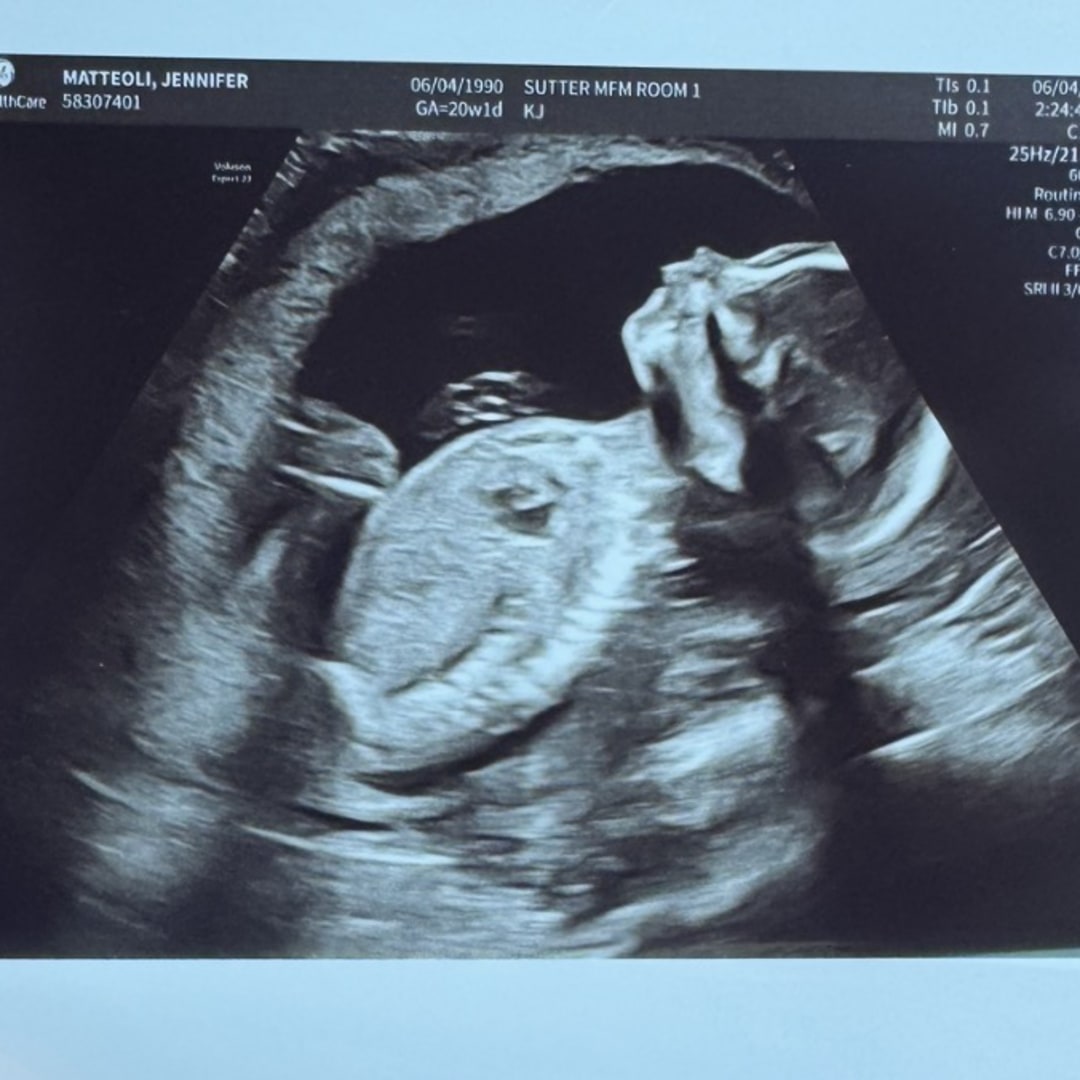 Photo shared by Jennifer for their Babylist baby registry.