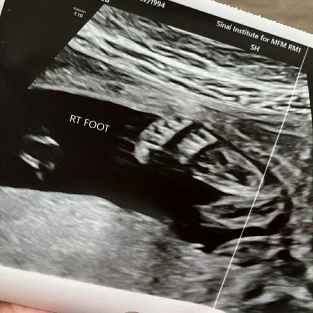Photo shared by Gherell Mae for their Babylist baby registry.